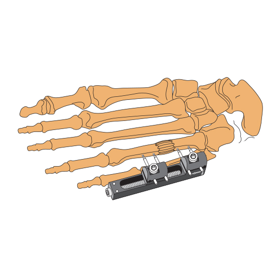 IMD Finger Rail