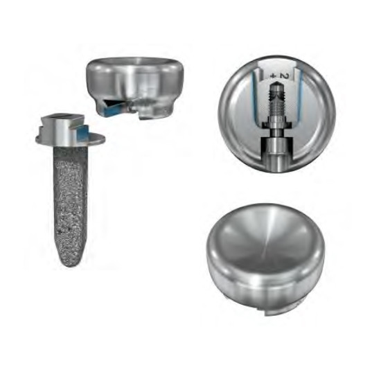 Radial Head IMD