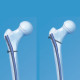 Adolesan Femur Pediatric
