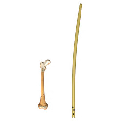 Retrograde Femoral