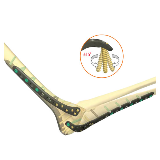 Distal Humerus
