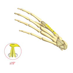 Mini Plate – Hand and Foot 