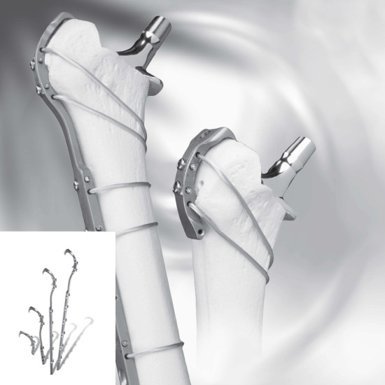 Proximal Femur